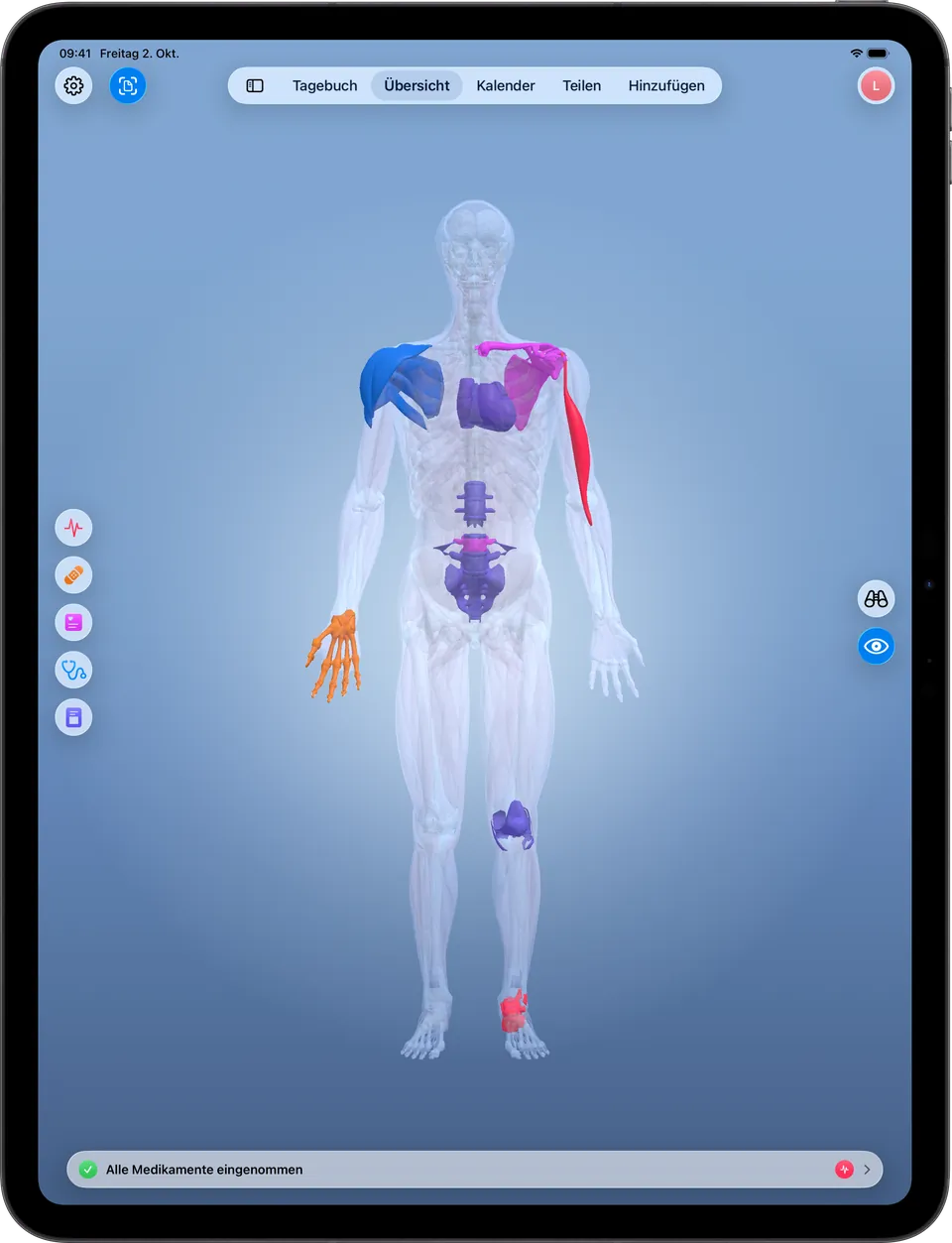 Clino auf dem iPad: die 3D-Körperkarte mit markierten Stellen, Filtern nach Kategorie und den Modi Ansehen und Navigieren
