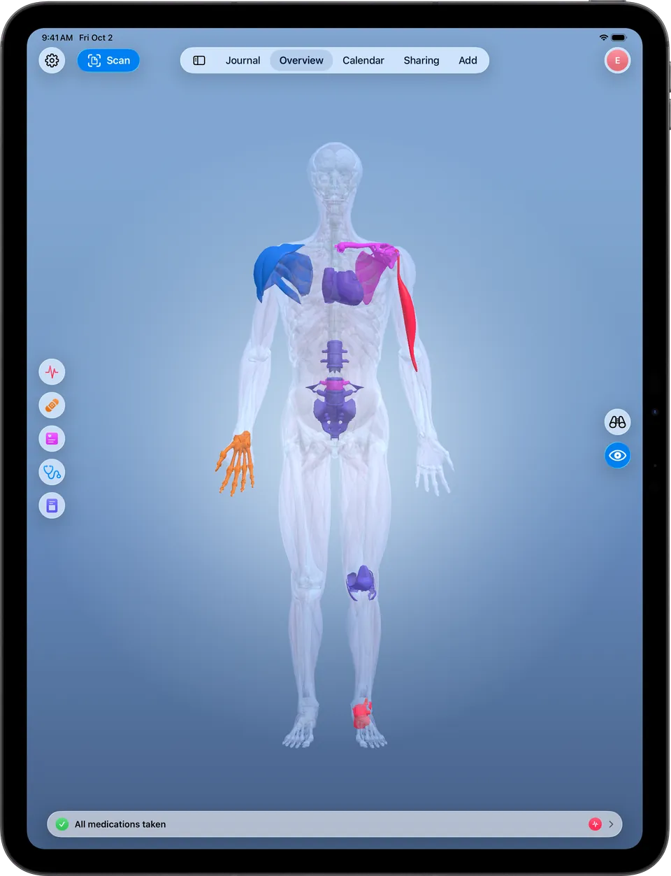Clino on iPad: the 3D body map with highlighted sites, category filters and the View and Navigate modes