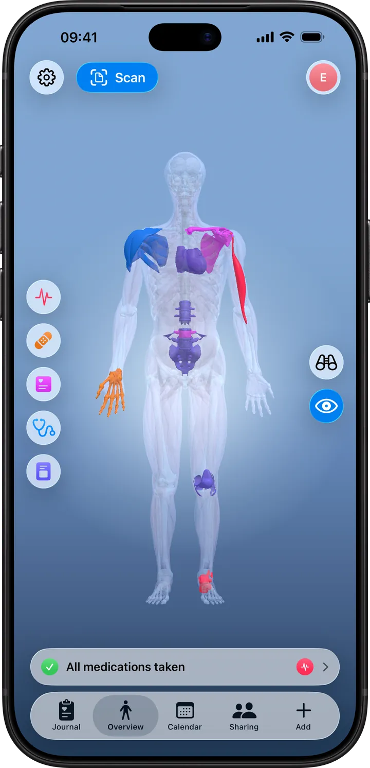 Clino on iPhone: the Overview tab with a 3D body map showing symptoms, visits, exams and therapies, color-coded by category