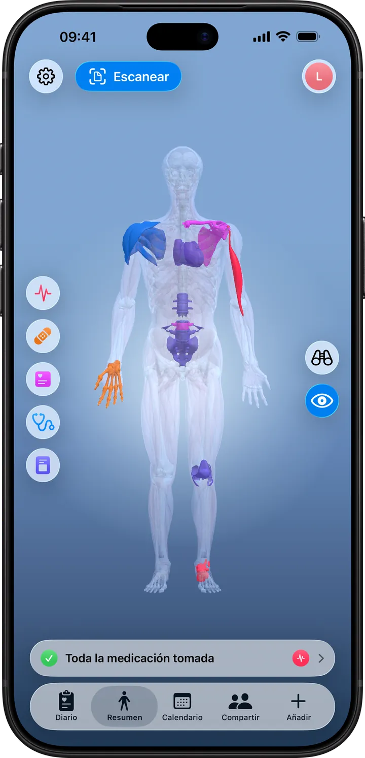 Clino en el iPhone: la pestaña Resumen con el mapa del cuerpo en 3D y las zonas de síntomas, visitas, exámenes y terapias por colores