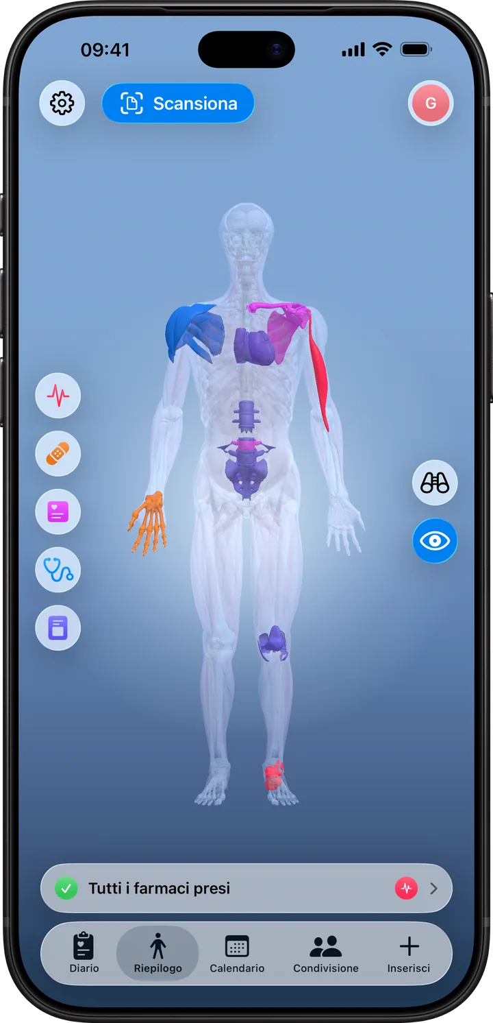 Clino su iPhone: il Riepilogo con la mappa del corpo 3D e le sedi di sintomi, visite, esami e terapie, colorate per tipologia